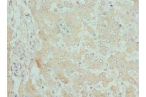 Immunohistochemistry of paraffin-embedded human liver tissue using ABIN7146778 at dilution of 1:100