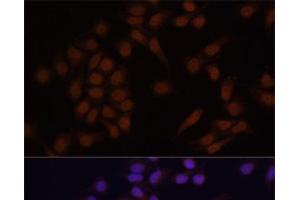 Immunofluorescence analysis of NIH/3T3 cells using PRDM14 Polyclonal Antibody at dilution of 1:100.