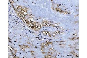 IHC analysis of ADK using anti-ADK antibody (ABIN4886430). (ADK antibody  (AA 165-351))