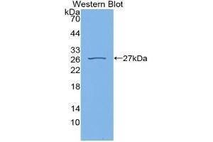 Detection of Recombinant CYPD, Rat using Polyclonal Antibody to Cyclophilin 40 (CYP-40) (PPID antibody  (AA 7-191))