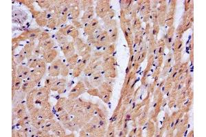 IHC image of ABIN7173586 diluted at 1:200 and staining in paraffin-embedded human heart tissue performed on a Leica BondTM system. (Cardiac Troponin T2 antibody  (AA 138-298))