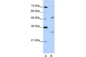 WB Suggested Anti-WBSCR1 Antibody Titration:  2. (EIF4H antibody  (Middle Region))