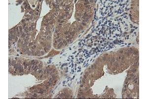 Image no. 6 for anti-Mitogen-Activated Protein Kinase Kinase 3 (MAP2K3) antibody (ABIN1499401)