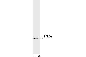 Western Blotting (WB) image for anti-Fas (TNFRSF6)-Associated Via Death Domain (FADD) antibody (ABIN967524) (FADD antibody)