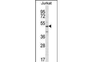 ABI2 Antibody (N-term)  western blot analysis in Jurkat cell line lysates (35 μg/lane). (ABI2 antibody  (N-Term))