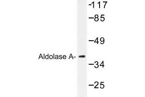Image no. 1 for anti-Aldolase A, Fructose-Bisphosphate (ALDOA) antibody (ABIN272155) (ALDOA antibody)