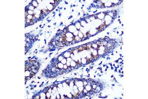 Immunohistochemistry of paraffin-embedded human colon using Monoamine Oxidase B (MAOB) (MAOB) Rabbit mAb (ABIN7268682) at dilution of 1:100 (40x lens). (Monoamine Oxidase B antibody)