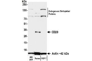 Western Blotting (WB) image for anti-Biotin antibody (ABIN7795748) (Recombinant Biotin antibody)