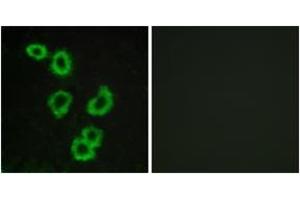Immunofluorescence analysis of MCF7 cells, using GPR176 Antibody. (GPR176 antibody  (AA 466-515))