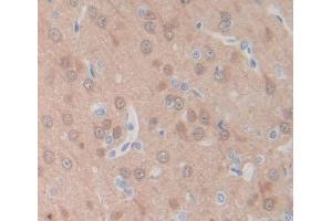 Used in DAB staining on fromalin fixed paraffin- embedded brain tissue (PLSCR4 antibody  (AA 1-299))