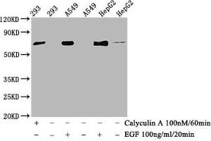 Western Blot Positive WB detected in 293 whole cell lysate,A549 whole cell lysate,HepG2 whole cell lysate(treated with Calyculin A or EGF) All lanes Phospho-ATF2 antibody at 1. (Recombinant ATF2 antibody  (Thr71))