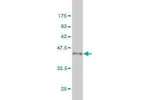 Western Blot detection against Immunogen (36. (Exportin 2 antibody  (AA 872-971))