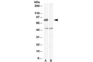 Western blot testing of human brain [frontal cortex] lysate with [B] and without [A] immunizing peptide using ZDHHC8 antibody at 0. (ZDHHC8 antibody)