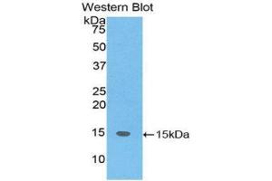 Western Blotting (WB) image for anti-SH2 Domain Containing 1A (SH2D1A) (AA 18-115) antibody (ABIN1860543) (SH2D1A antibody  (AA 18-115))