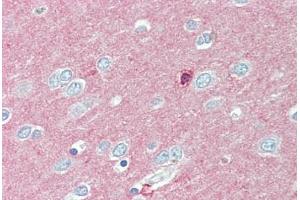 Anti-CADM2 antibody  ABIN1100376 IHC staining of human brain, cortex. (CADM2 antibody  (Internal Region))