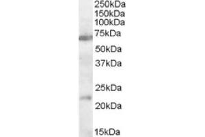 Image no. 1 for anti-Cholinergic Receptor, Nicotinic, alpha 4 (CHRNA4) (AA 29-43), (Internal Region) antibody (ABIN375184)