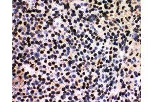 Anti-splicing factor 1 antibody, IHC(F) IHC(F): Rat Spleen Tissue (Splicing Factor 1 antibody  (N-Term))