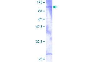 PRKG1 Protein (AA 1-686) (GST tag)