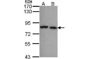 WB Image Sample (30 ug of whole cell lysate) A: A431 , B: H1299 7. (Calpain 5 antibody)