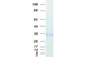 Western Blotting (WB) image for Epithelial Cell Adhesion Molecule (EPCAM) protein (Myc-DYKDDDDK Tag) (ABIN2713654)