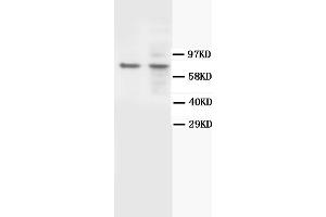 Western Blotting (WB) image for anti-BRCA1 Associated Protein-1 (Ubiquitin Carboxy-terminal Hydrolase) (BAP1) antibody (ABIN1105494) (BAP1 antibody)
