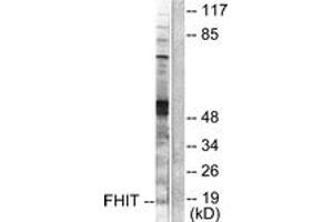 Western blot analysis of extracts from A549 cells, using FHIT Antibody. (FHIT antibody  (AA 81-130))