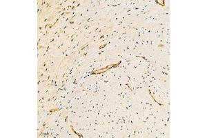 Immunohistochemistry analysis of paraffin embedded mouse heart using ACTN1 (ABIN7072905) at dilution of 1: 300 (ACTN1 antibody)
