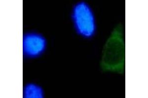 Immunofluorescence (IF) image for anti-Human Papilloma Virus Type 18 (HPV-18) (AA 1-83), (N-Term) antibody (ABIN781773) (HPV18 antibody  (N-Term))