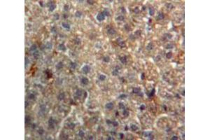 Used in DAB staining on fromalin fixed paraffin-embedded Liver tissue (Importin 8 antibody  (AA 417-622))