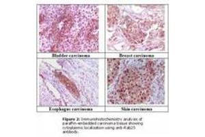 Image no. 1 for anti-RAB25, Member RAS Oncogene Family (RAB25) antibody (ABIN207613) (RAB25 antibody)