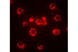 Immunofluorescent analysis of CD288 staining in MCF7 cells. (TLR8 antibody)