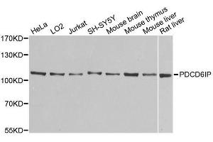 Western blot analysis of extracts of various cell lines, using PDCD6IP antibody. (ALIX antibody  (AA 1-180))