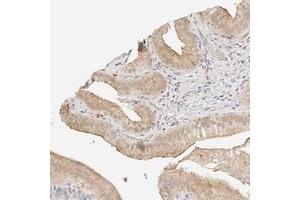 Immunohistochemical staining of human gallbladder with ZNF642 polyclonal antibody  shows moderate membrane and cytoplasmic positivity in glandular cells at 1:200-1:500 dilution.