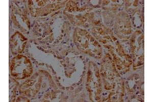 IHC image of ABIN7156171 diluted at 1:200 and staining in paraffin-embedded human kidney tissue performed on a Leica BondTM system. (RHBDF2 antibody  (AA 1-200))