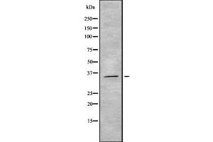 Western blot analysis OR5M3 using HeLa whole cell lysates (OR5M3 antibody)