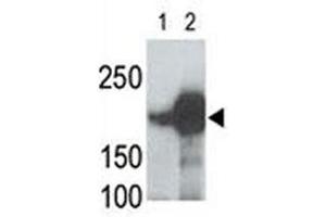 LRP5 antibody used in western blot to detect recombinant human LRP5 (Lane 1) and mouse LRP5 (2) proteins in transfected 293 cell lysate (LRP5 antibody  (AA 1538-1567))
