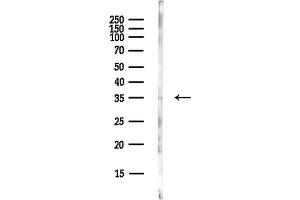 anti-X-Ray Repair Complementing Defective Repair in Chinese Hamster Cells 3 (XRCC3) (N-Term) antibody