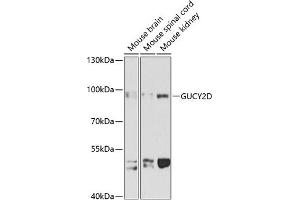 Western blot analysis of extracts of various cell lines, using GUCY2D antibody (ABIN1680144, ABIN3017868, ABIN3017870 and ABIN6220291) at 1:1000 dilution. (GUCY2D antibody  (AA 52-350))
