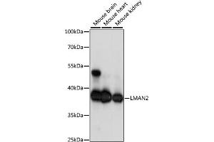 Western blot analysis of extracts of various cell lines, using LM antibody (ABIN7268203) at 1:1000 dilution. (LMAN2 antibody  (AA 190-320))