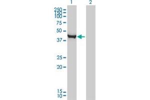 Western Blot analysis of CTH expression in transfected 293T cell line by CTH monoclonal antibody (M03), clone S51. (CTH antibody  (AA 1-405))