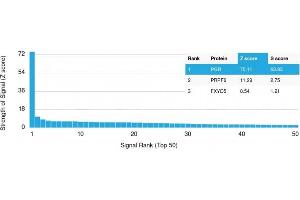 Analysis of Protein Array containing more than 19,000 full-length human proteins using Progesterone Receptor Mouse Monoclonal Antibody (PGR/2694). (Progesterone Receptor antibody  (AA 483-571))