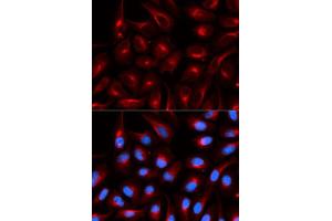 Immunofluorescence analysis of U20S cell using TLE1 antibody.