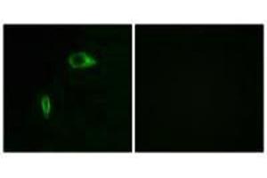 Immunofluorescence analysis of HeLa cells, using Collagen XIV α1 antibody. (COL14A1 antibody)