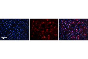 Rabbit Anti-RAD54B Antibody      Formalin Fixed Paraffin Embedded Tissue: Human Adult Liver   Observed Staining: Nuclear in hepatocytes, strong signal, wide tissue distribution  Primary Antibody Concentration: 1:100  Secondary Antibody: Donkey anti-Rabbit-Cy3  Secondary Antibody Concentration: 1:200  Magnification: 20X  Exposure Time: 0. (RAD54B antibody  (Middle Region))