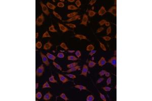 Immunofluorescence analysis of L929 cells using STUB1 Polyclonal Antibody (ABIN6129459, ABIN6148649, ABIN6148650 and ABIN6215447) at dilution of 1:100 (40x lens). (STUB1 antibody  (AA 1-303))