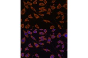 Immunofluorescence analysis of L929 cells using STUB1 Polyclonal Antibody (ABIN6129459, ABIN6148649, ABIN6148650 and ABIN6215447) at dilution of 1:100 (40x lens).