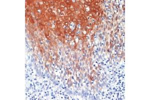 Immunohistochemistry of paraffin-embedded human tonsil using S100 antibody (ABIN7270129) at dilution of 1:200 (40x lens). (S100A8 antibody  (AA 1-93))