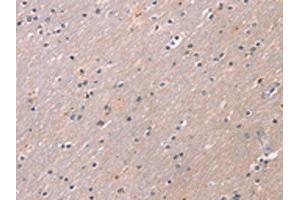 The image on the left is immunohistochemistry of paraffin-embedded Human brain tissue using ABIN7191189(KCNK3 Antibody) at dilution 1/20, on the right is treated with synthetic peptide. (KCNK3 antibody)
