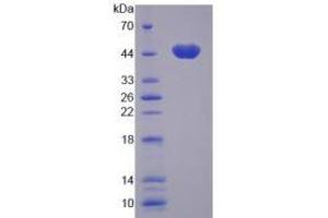 SDS-PAGE (SDS) image for Calcium/calmodulin-Dependent Protein Kinase I (CAMK1) (AA 1-370) protein (His tag) (ABIN4989696)
