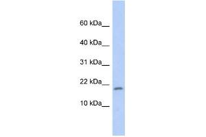 WB Suggested Anti-RPS15 Antibody Titration: 0. (RPS15 antibody  (Middle Region))